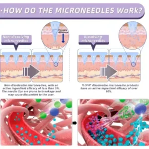 TLOPA® 𝐋𝐚𝐥𝐮𝐭𝐢𝐝𝐞 Nano Microneedle Patch