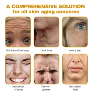 TLOPA® Botox Bee Venom Wrinkle Removal Cream