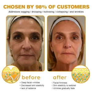 TLOPA® Botox Bee Venom Wrinkle Removal Cream
