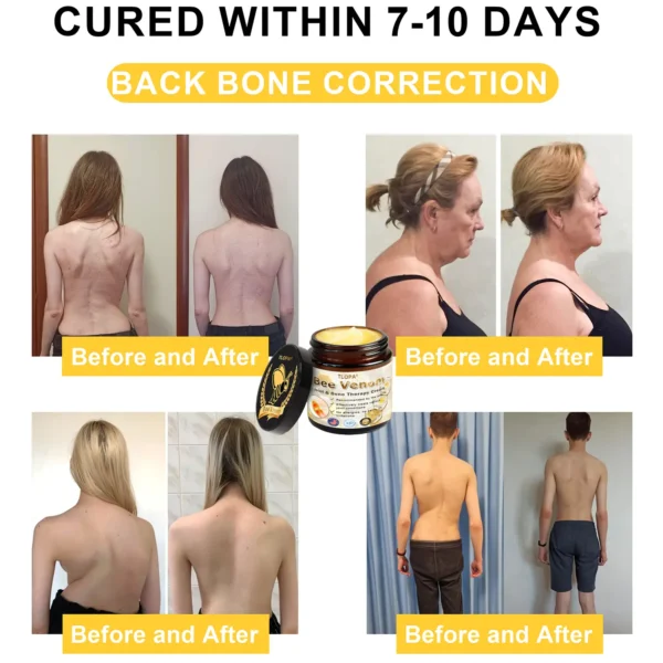 TLOPA™ Powerful All-Body Skin Treatment Cream