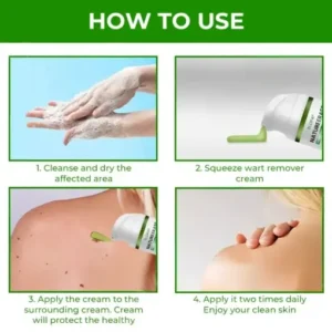 TLOPA® SUPER NatureErase Instant Mole & Spot Cream
