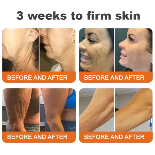 TLOPA® Botox Bee Venom Firming Serum Stick