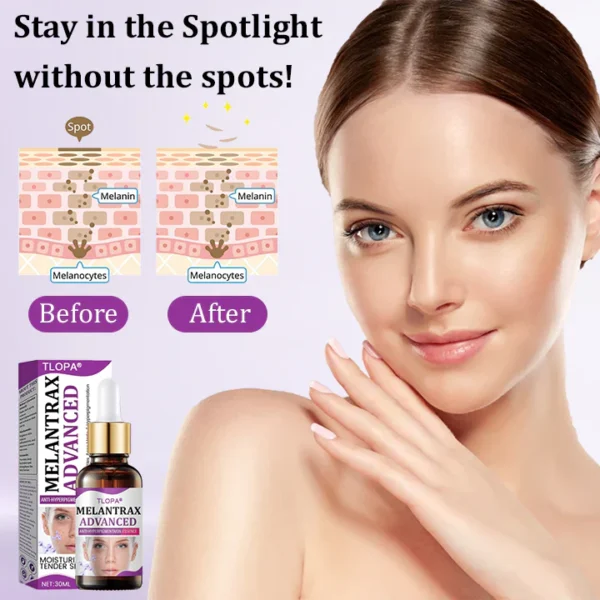 TLOPA® MelantraX Advanced Anti-Hyperpigmentation Essence