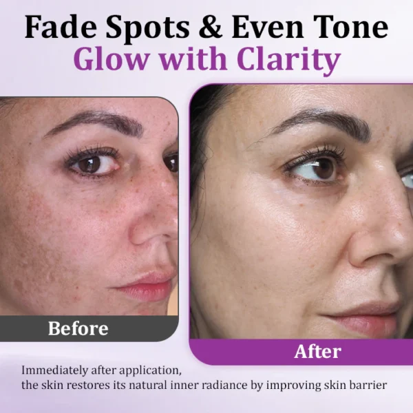 TLOPA® MelantraX Advanced Anti-Hyperpigmentation Essence