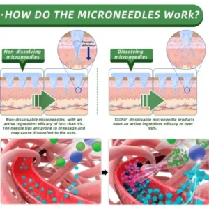 𝗧𝗟𝗢𝗣𝗔® 𝗚𝗟𝗣-𝟭 Nano Microneedle Patch