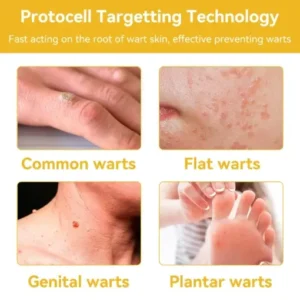 𝗧𝗟𝗢𝗣𝗔® Bee Venom Skin Treatment Cream