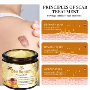𝗧𝗟𝗢𝗣𝗔® Bee Venom Skin Treatment Cream