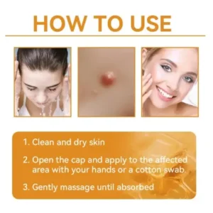 𝗧𝗟𝗢𝗣𝗔® Bee Venom Skin Treatment Cream