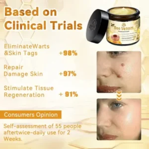 𝗧𝗟𝗢𝗣𝗔® Bee Venom Skin Treatment Cream