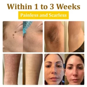 𝗧𝗟𝗢𝗣𝗔® Bee VenomSkin Restoration Cream