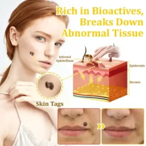 𝗧𝗟𝗢𝗣𝗔® Bee VenomSkin Restoration Cream