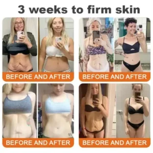 TLOPA® 𝑩𝒆𝒆 𝑽𝒆𝒏𝒐𝒎 𝑴𝒖𝒍𝒕𝒊-𝑺𝒚𝒎𝒑𝒕𝒐𝒎 𝑺𝒌𝒊𝒏 𝑻𝒓𝒆𝒂𝒕𝒎𝒆𝒏𝒕 𝑪𝒓𝒆𝒂𝒎