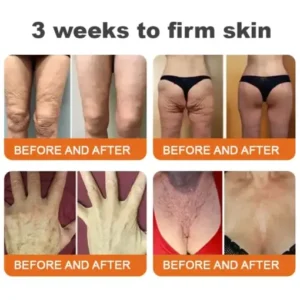 TLOPA® 𝑩𝒆𝒆 𝑽𝒆𝒏𝒐𝒎 𝑴𝒖𝒍𝒕𝒊-𝑺𝒚𝒎𝒑𝒕𝒐𝒎 𝑺𝒌𝒊𝒏 𝑻𝒓𝒆𝒂𝒕𝒎𝒆𝒏𝒕 𝑪𝒓𝒆𝒂𝒎