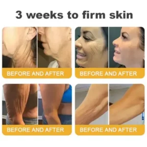 TLOPA® Botox Bee Venom Anti-Aging Firming Gel