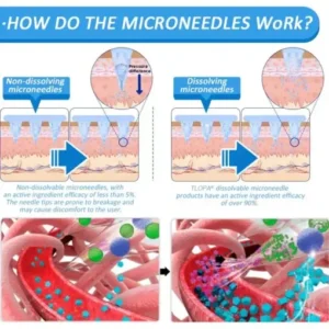 TLOPA® Nano Microneedle Patch with SMGT-GLP-1 & Matrixyl 3000 – Slimming,👨‍⚕️ Skin Tightening, Blood Sugar Support, No Injection, 7-Day Result