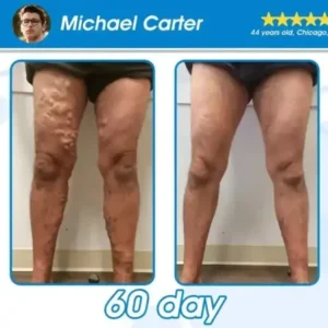 TL𝗢𝙿𝙰® 𝐆 𝐋 𝐏-𝟏 𝗠𝗲𝘁𝗮𝗯𝗼𝗹𝗶𝗰 Support – 𝗨𝗹𝘁𝗿𝗮 𝗖𝗼𝗻𝗰𝗲𝗻𝘁𝗿𝗮𝘁𝗲𝗱 𝗟𝗶𝗾𝘂𝗶𝗱