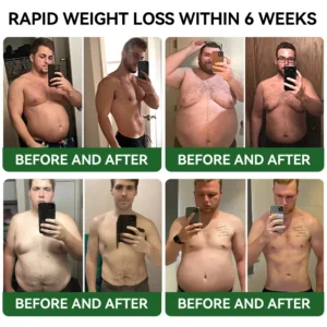 𝐓𝐋𝐎𝐏𝐀® 𝐆𝐋𝐏-𝟏 𝐒𝐥𝐢𝐦𝐦𝐢𝐧𝐠 & 𝐇𝐞𝐚𝐥𝐭𝐡 𝐁𝐨𝐨𝐬𝐭 𝐃𝐫𝐨𝐩𝐬👨‍⚕️(𝐅𝐨𝐨𝐝-𝐠𝐫𝐚𝐝𝐞 𝐅𝐚𝐭 𝐁𝐮𝐫𝐧𝐞𝐫)