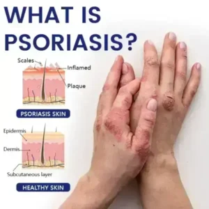 Cougex® DermaSooth Repair Cream